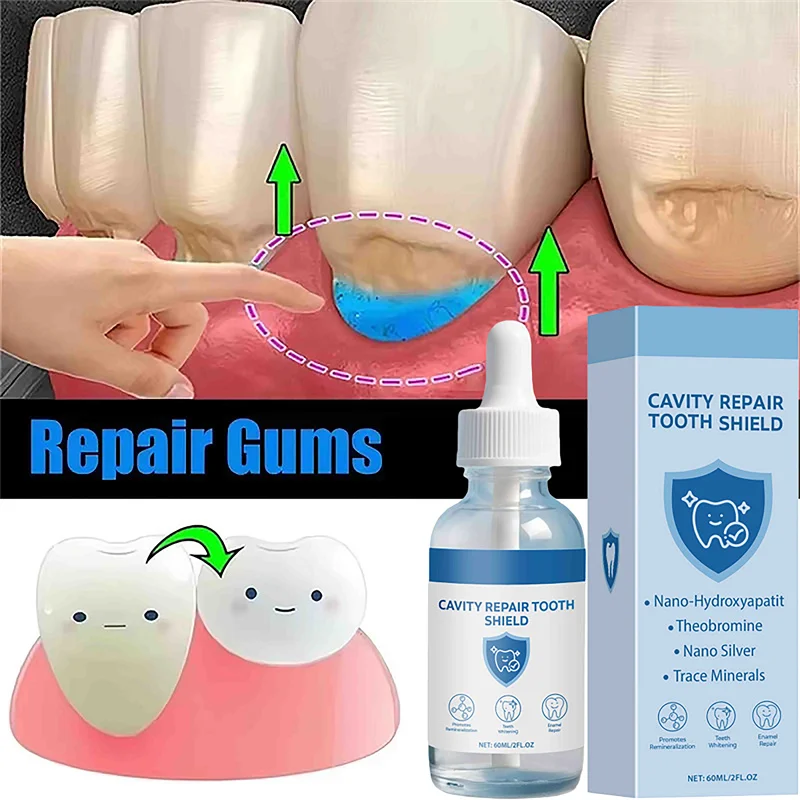 

Rapid Repair Gums Serum60ML Effectively Relieve Tooth Allergy Dental Caries Tooth Cleaning Toothpaste Relieve Tooth Damage Drops