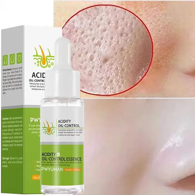 Pores Acne Treatment Essence Lactobionic Acid Pore Shrinking Facial Serum Blackhead Removal Repairing Gel Oil Control Skin Care