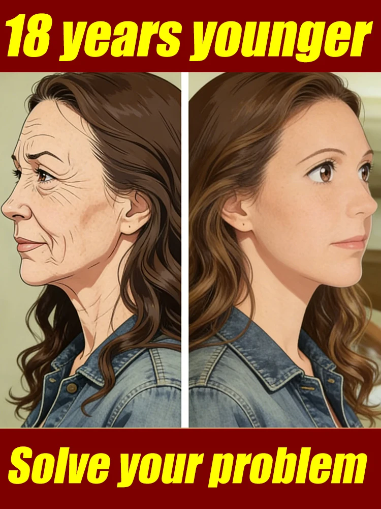 

NO Wrinkle, 20 years younger.full body face.More discounts on packages