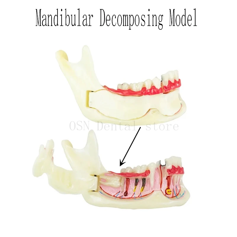  Mandible Dental Teaching Model Teeth Structure Can Open Demonstration Anatomical Model Teaching Model for Student Studying