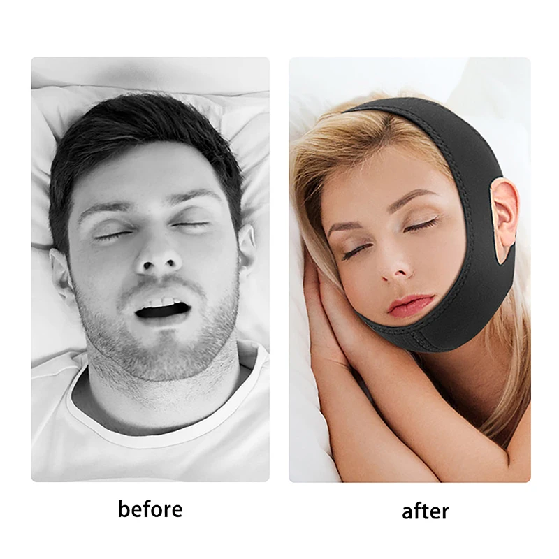 Adjustable New Neoprene Anti Snoring Strap Stop Snoring Chin Strap Snoring Mouth Guard Snoring Treat Snore Relieve for Sleep