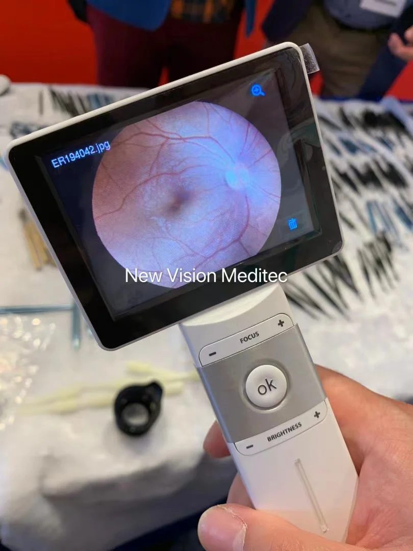 MiiS Fundus Camera Horus Caméra Fundus portable Caméra réinale