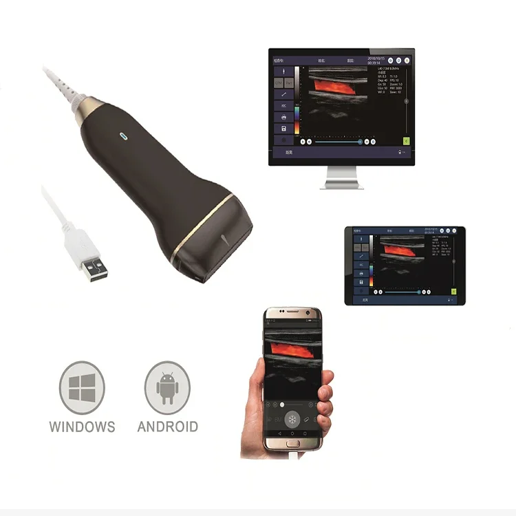 Fabrieksprijs Medische Healson C30c Convexe Handheld Echografie Sonde