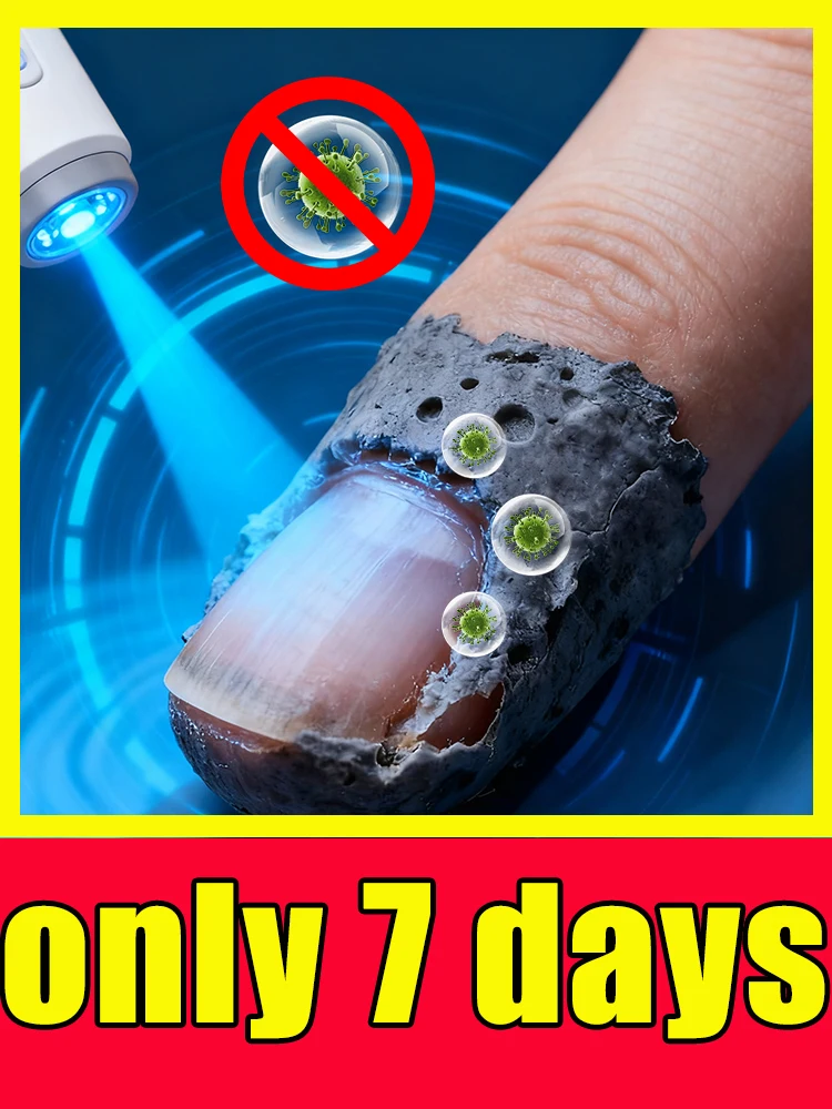 

The nail fungus crisis is over, and the latest laser products are in action