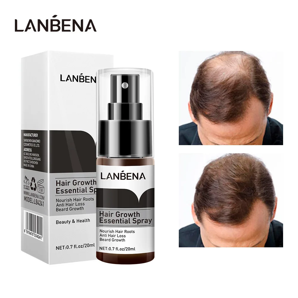 

LANBENA Hair Growth Essence Spray Product Preventing Baldness Consolidating Anti Hair Loss Nourish Roots Easy To Carry Hair Care