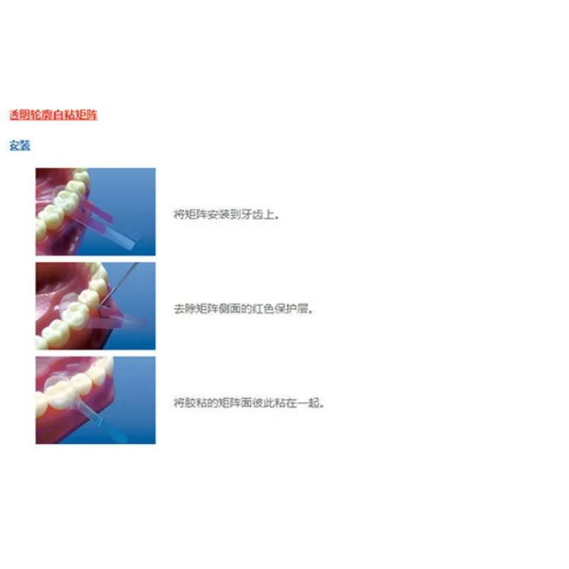12Pcs/box Lab Material Self-adhesive Anterior Teeth Transparent Contour Matrix Belt 1.491 for Laboratory Technicians s