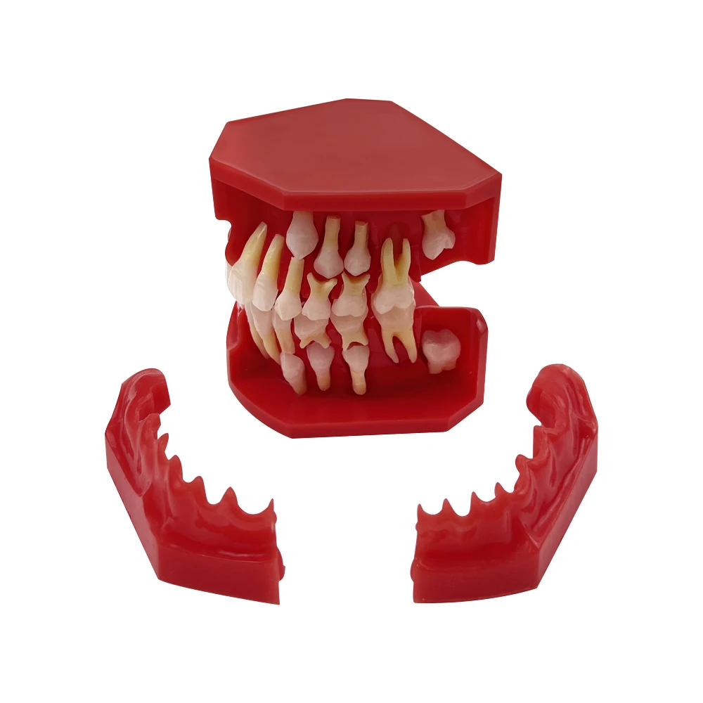 Dental Model Children Teeth Primary Permanent Teeth Alternate Model Replacement Tooth Development Demonstration Model Dentistry