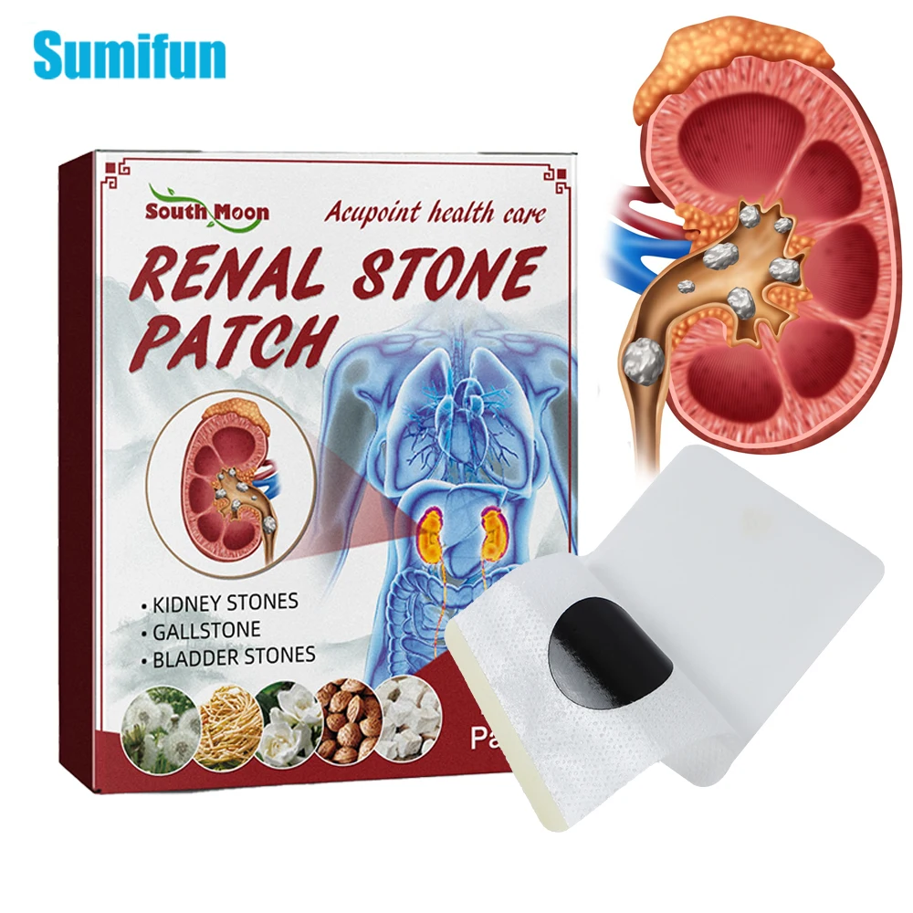 

12pcs/box New Kidney Stones Removal Plaster Treat Gallstones Renal Calculus Medicinal Patches Urolithiasis Pain Relief Stickers