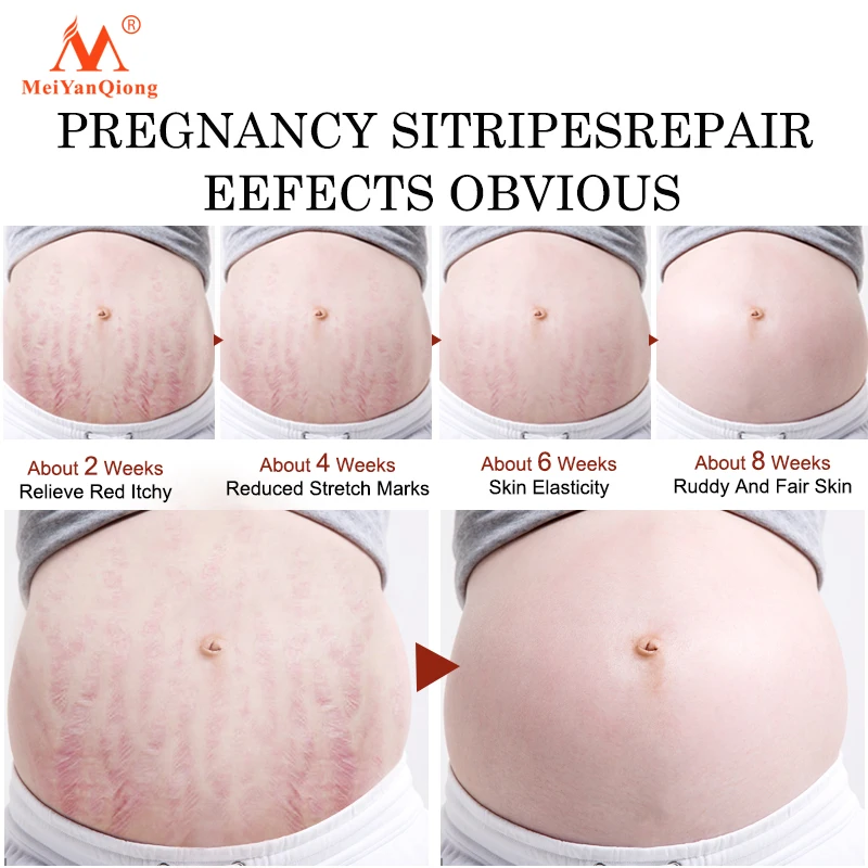 Postpartum repairing body cream, can remove stretch marks and postpartum scars, with a gentle texture and delicate texture