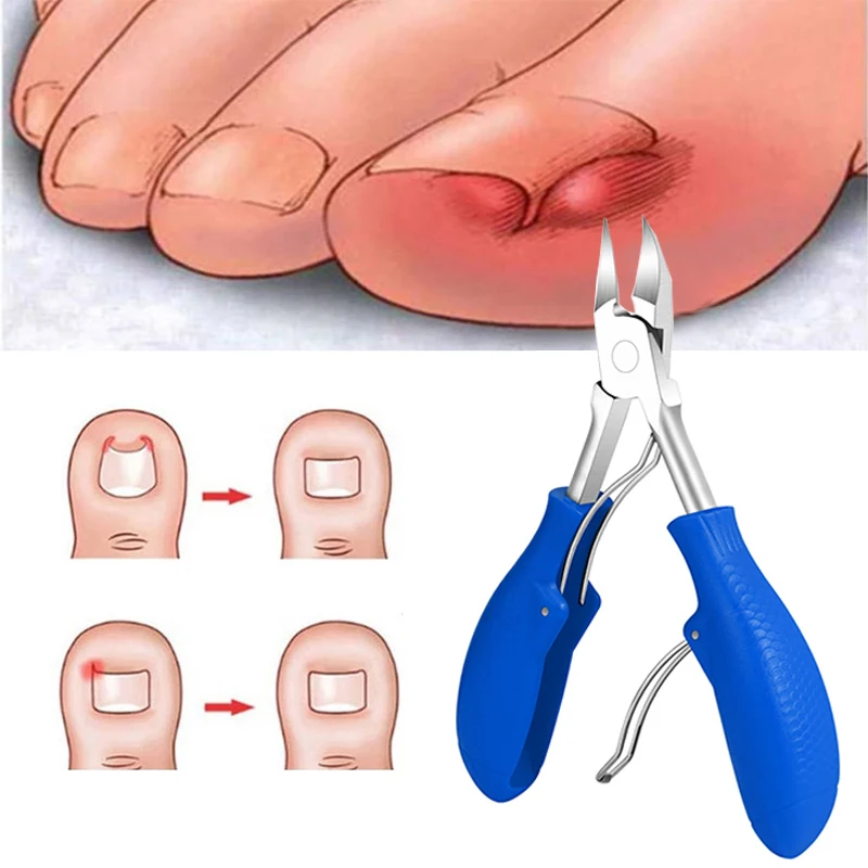 Cortadores de unha de aço inoxidável Removedor de pele morta Pinças Engrown Cortadores de cuidados com os pés Ferramenta de manicure Pedicure Scissors