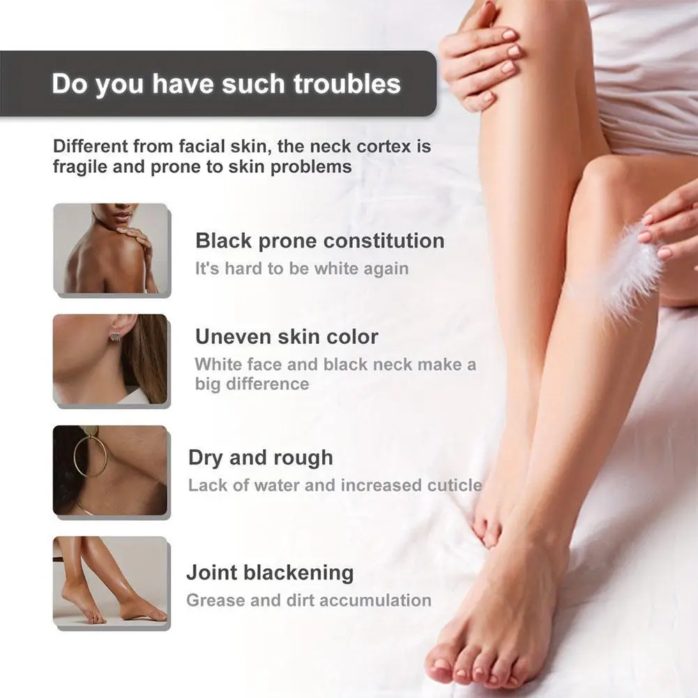 كريم تبييض مبيض للأجزاء الحميمة والخاصة والوجه والجسم سريع تحت الإبط قوي 50 جم Y5D9