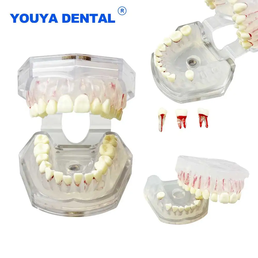 

28 Teeth model With Removable Root Canal Teeth Typodont RCT Practice Endodontic Practice Block Endo File Training Study