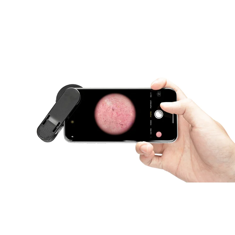 IBOOLO DE-300ใช้ Polarized Dermestid สำหรับ Dermatology