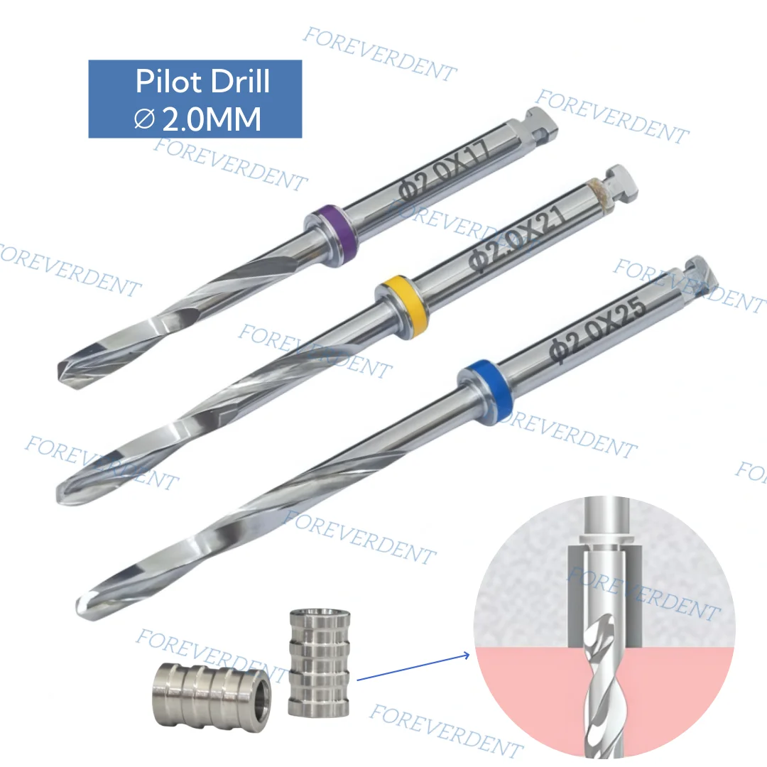 New Dental Pilot Drills Slevees Implant Fixing Nail Guide Digital Jaw Drill Universal Slevees 3x2.0x5mm