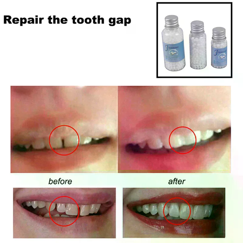 Dentures Props Halloween Temporary Tooth Repair Kit Falseteeth Gaps Solid Glue