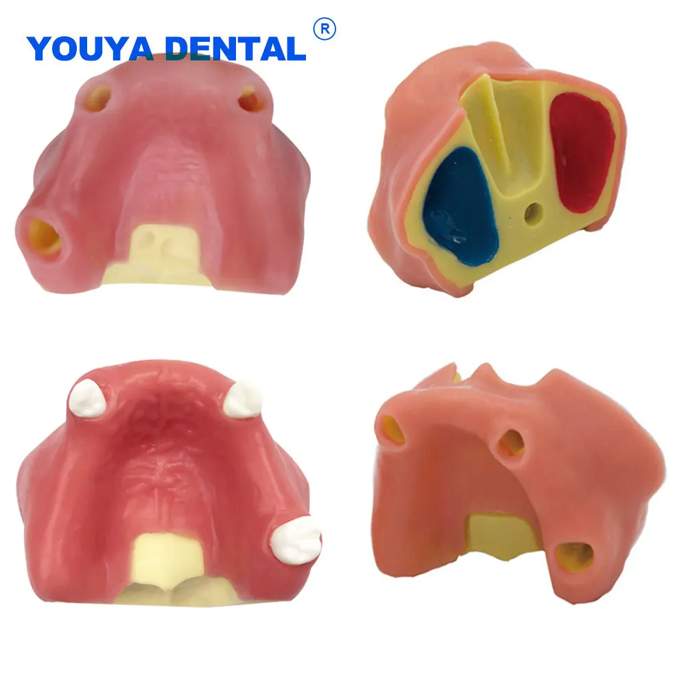 

Maxillary Sinus Teeth Practice Model Dental Implant Dental Implant Student Training Display Studying Upper Jaw Demo Models