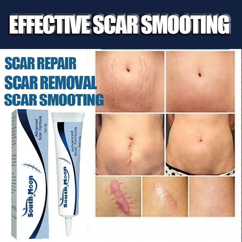 Krem ciążowy poprawiający elastyczność, delikatna pielęgnacja skóry po ciąży, eliminuje rozstępy i jest bardzo skuteczny