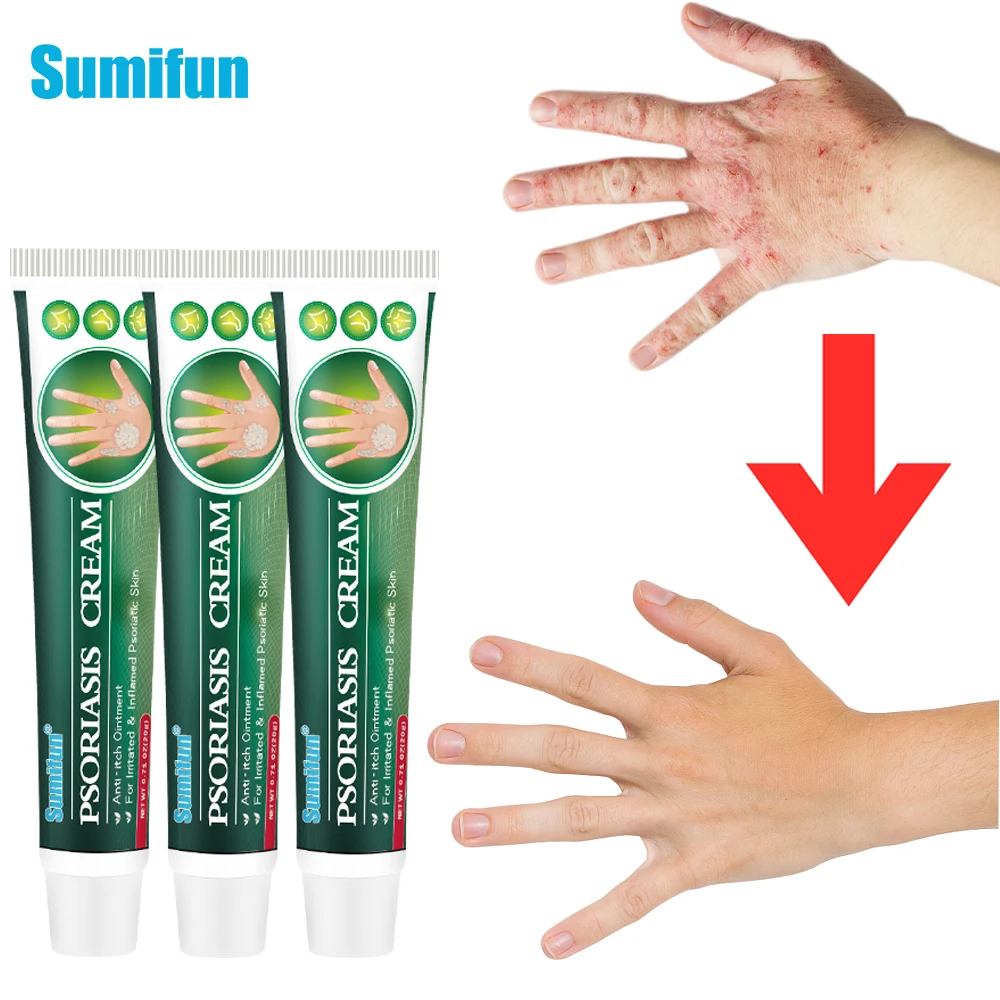 

3Pcs Psoriasis Antibacterial Cream Herbal Effective Anti-Itch Ointment Relief Dermatitis Eczema Treatment Urticaria Plaster