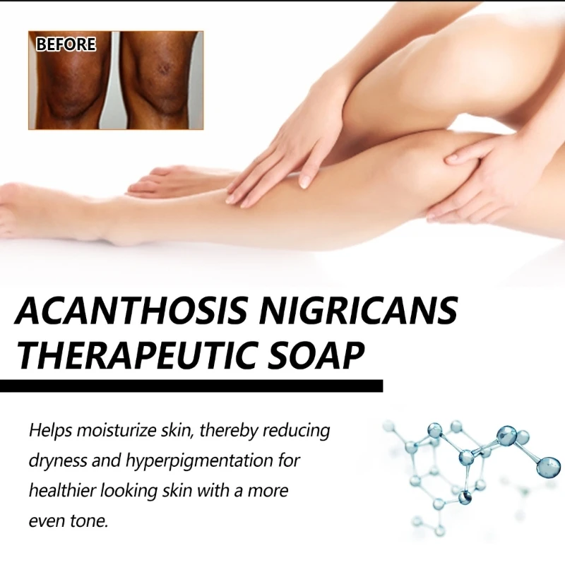 قالب صابون فحم الخيزران الطبيعي صابون الجسم مزيل الميلانين للركبة والرقبة 918D