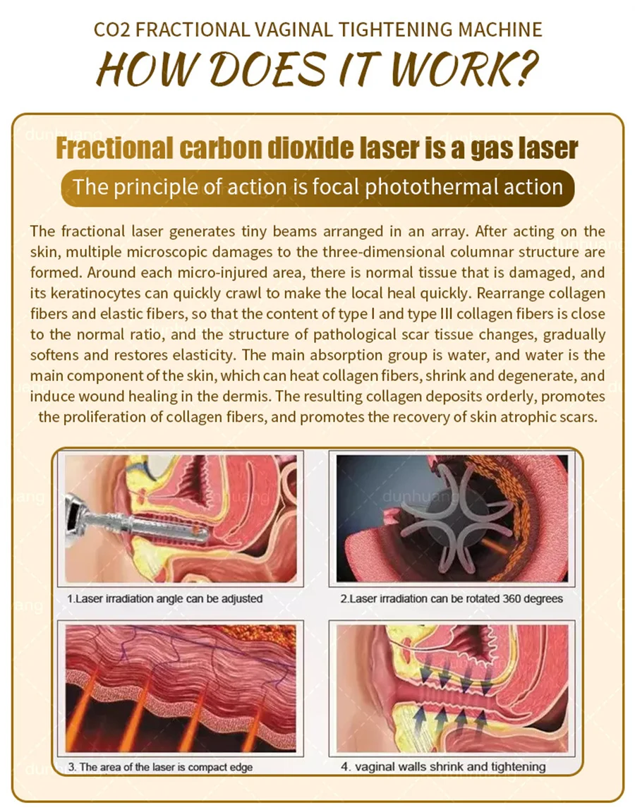 Fractional Laser Machine Professional Portable Co2 Bison Device 4d Fotona Mini Skin Gestational Mark Treatment Device Salon