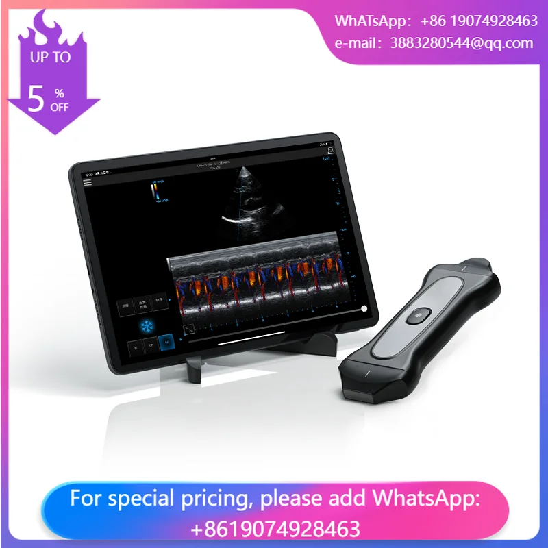 Periodmed Factory Price Portable Handheld Wireless Veterinary Ultrasound Scanner Color Doppler 3200mAh Battery Electricity
