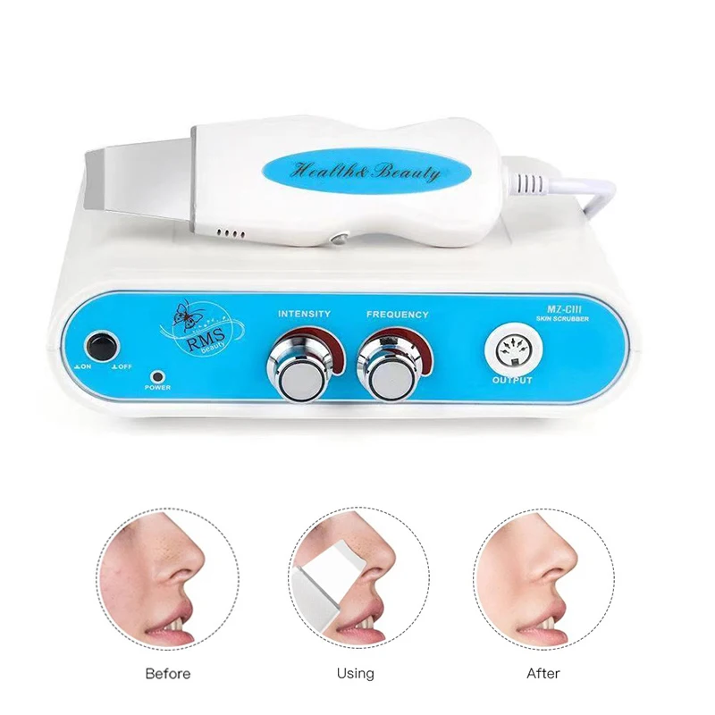 Ultrasonic Skin Scrubber เครื่องมือทําความสะอาดใบหน้า Blackhead Remover Minimizing Pore Spot ลบ Facial Peeling Skincare Beauty Machine