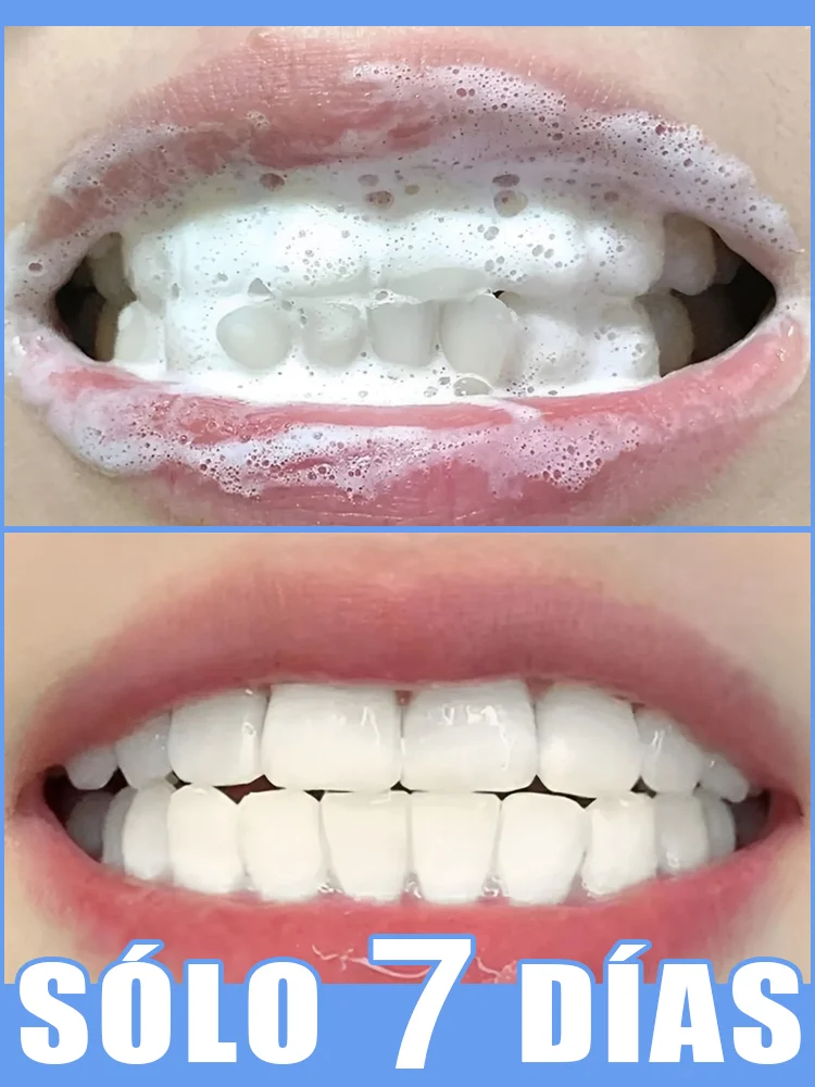 

Removes yellow stains, naturally whitens, eliminates bad breath, yellow teeth and repairs gums with just one brush