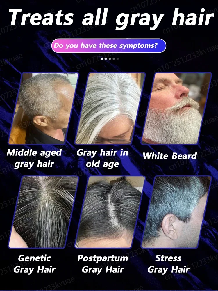 White hair killer, remove gray hair and restore natural hair color in 7 days