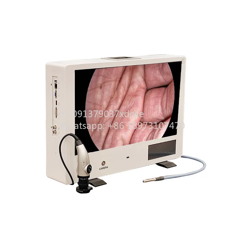 2026 New JOYMED Industrial . Electric Plastic Metal Endoscopic Camera 1080p HD Imaging System HDMI/USB/DVI Outputs CE Cert
