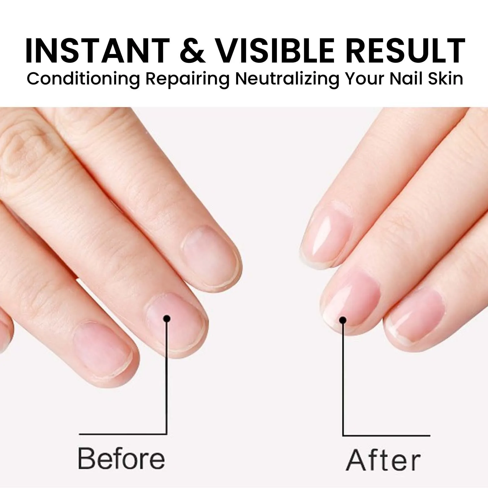 Nail Repair Serum Pro Brightening Nails Thickening Nails Toe Gray Nail Care,nail Restore & Renew, 30ml