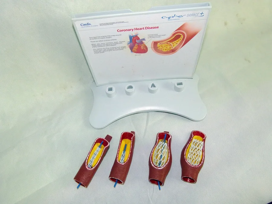 Vascular Stent Model Human Vascular Model Medical Human Teaching Pathological Vascular Anatomy Model