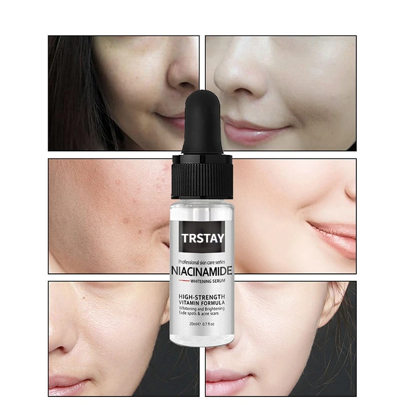 Effective Whitening Serum Remove Dark Spots Freckle Essence Anti-Aging Niacinamide Fade Pigmentation Melasma Brighten Skin Care