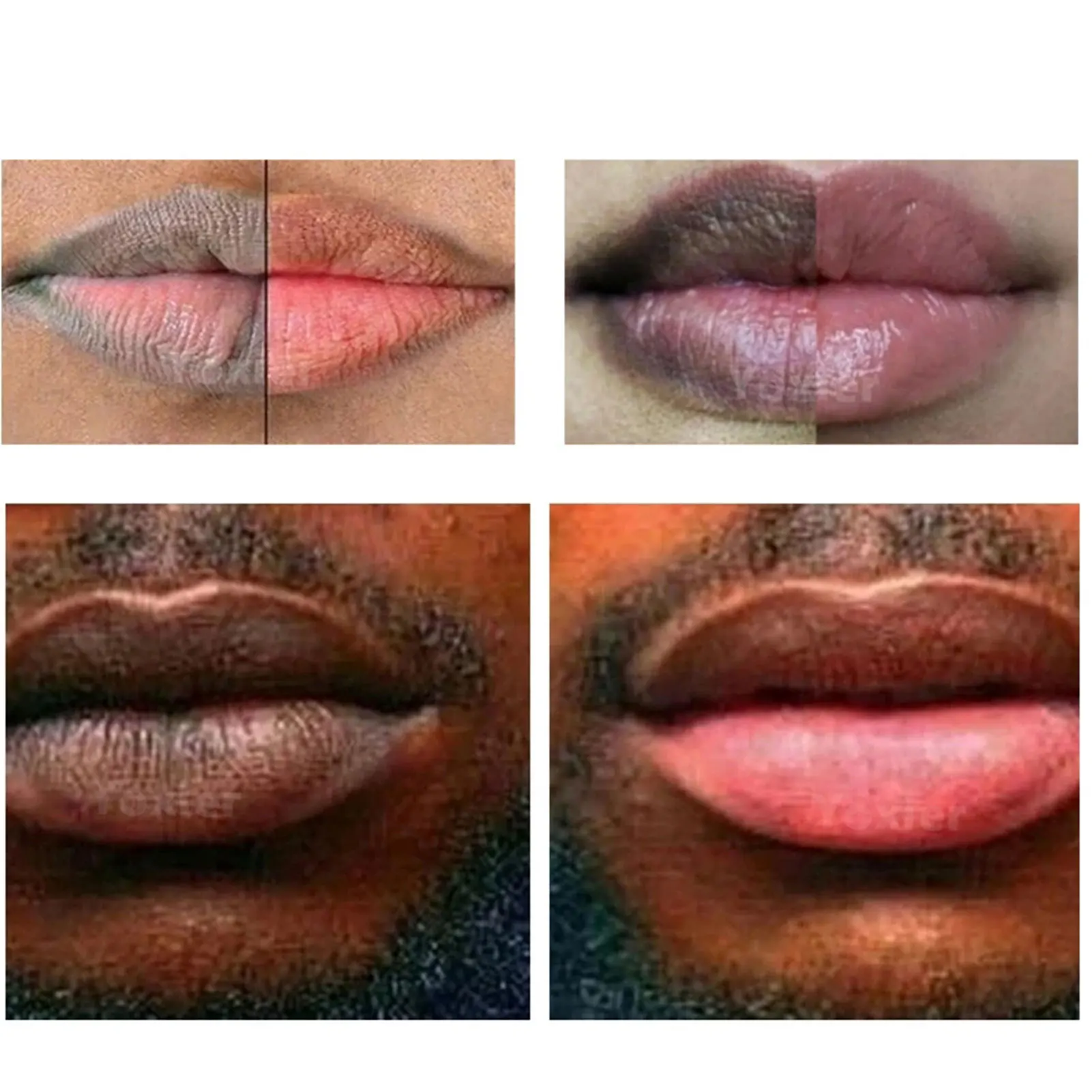 Lip Peeling Für Dunklen Lippen Groß 20g Trockenen Lippen Balsam Peeling Feuchtigkeitscreme Für Raucher Rauchen Männer Frauen Nacht Schlaf masken Erleichtern