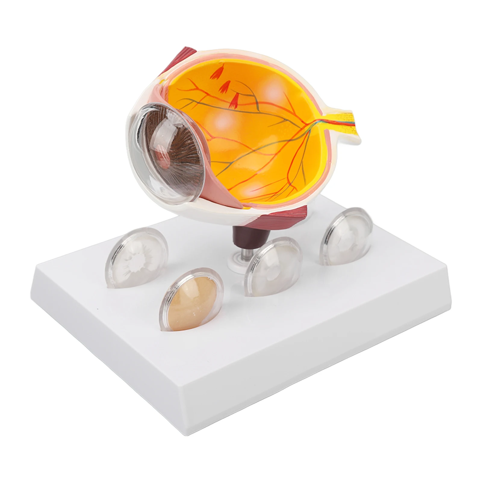 

Enlarged Human Eye Anatomical Model Accurate Shows Optic Cornea Lens Eyeball Model Cataracts Eyeball Model