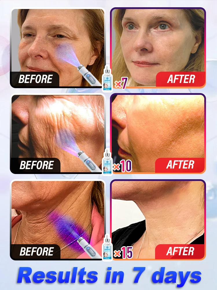 Wrinkles disappear, effective in seven days, guaranteed to satisfy you