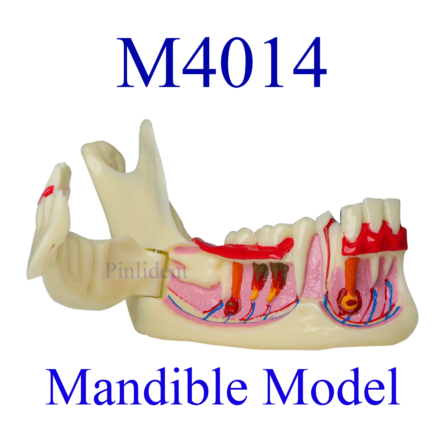 Dental Endodontic Model Gingival Anatomy Mandibular Tissue Model Anatomical Model Teaching Research Demonstration Caries M4014