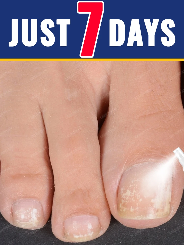 

Spray for beautiful nails: the greatest product of 2025