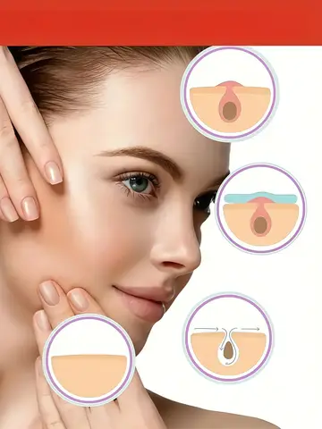 200/400/800pcs Invisible Clear Pimple Patch Set – Deep-Cleansing Hydrocolloid Acne Stickers, Mixed Sizes, Gentle & Skin-Friendly