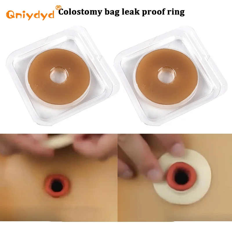 5PCS/10PCS Colostomy Bag Leak-proof Ring Ointment Stoma Ring Stoma Care Protection Skin Stoma Ring Bottom Plate