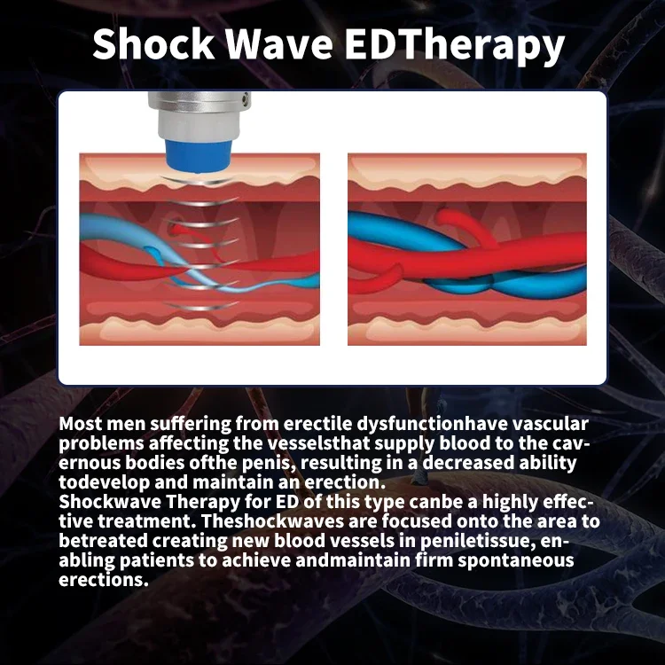 

Upgraded 7 Heads Shockwave Therapy Machine Muscle Massager Ballistic Lattice Physiotherapy for Pain Relief Tool