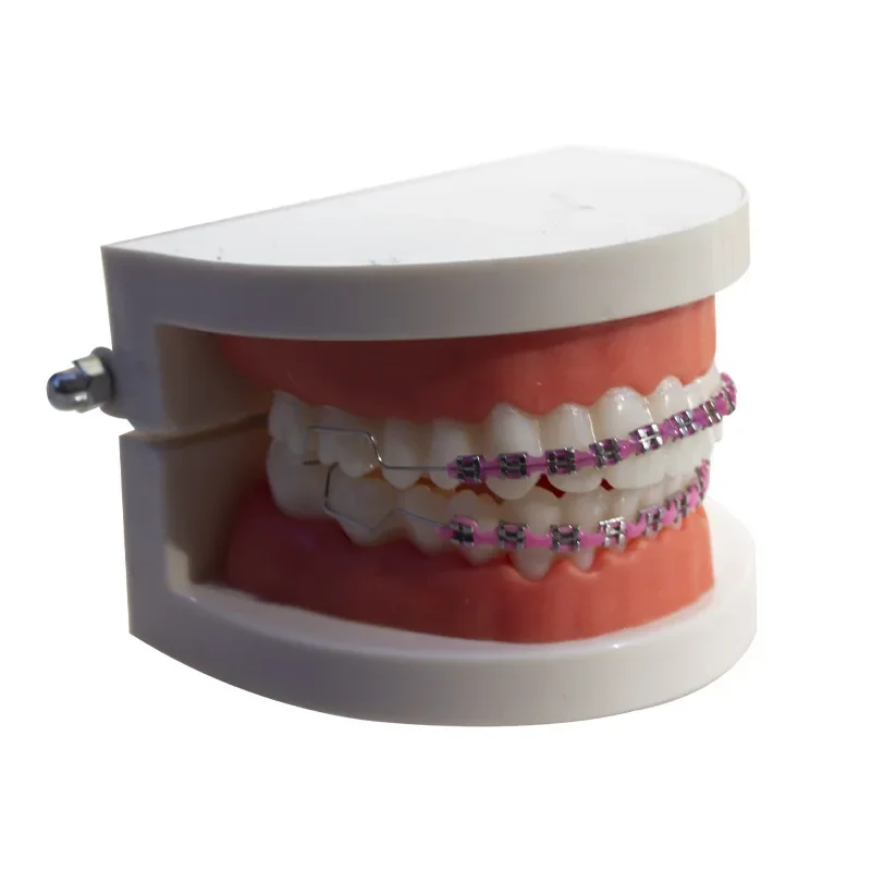 

1 Pair Temporary Tooth Decoration With Metal Wires Multicolour Metal Bracket Orthodontic Ligature Ties Dentist Material