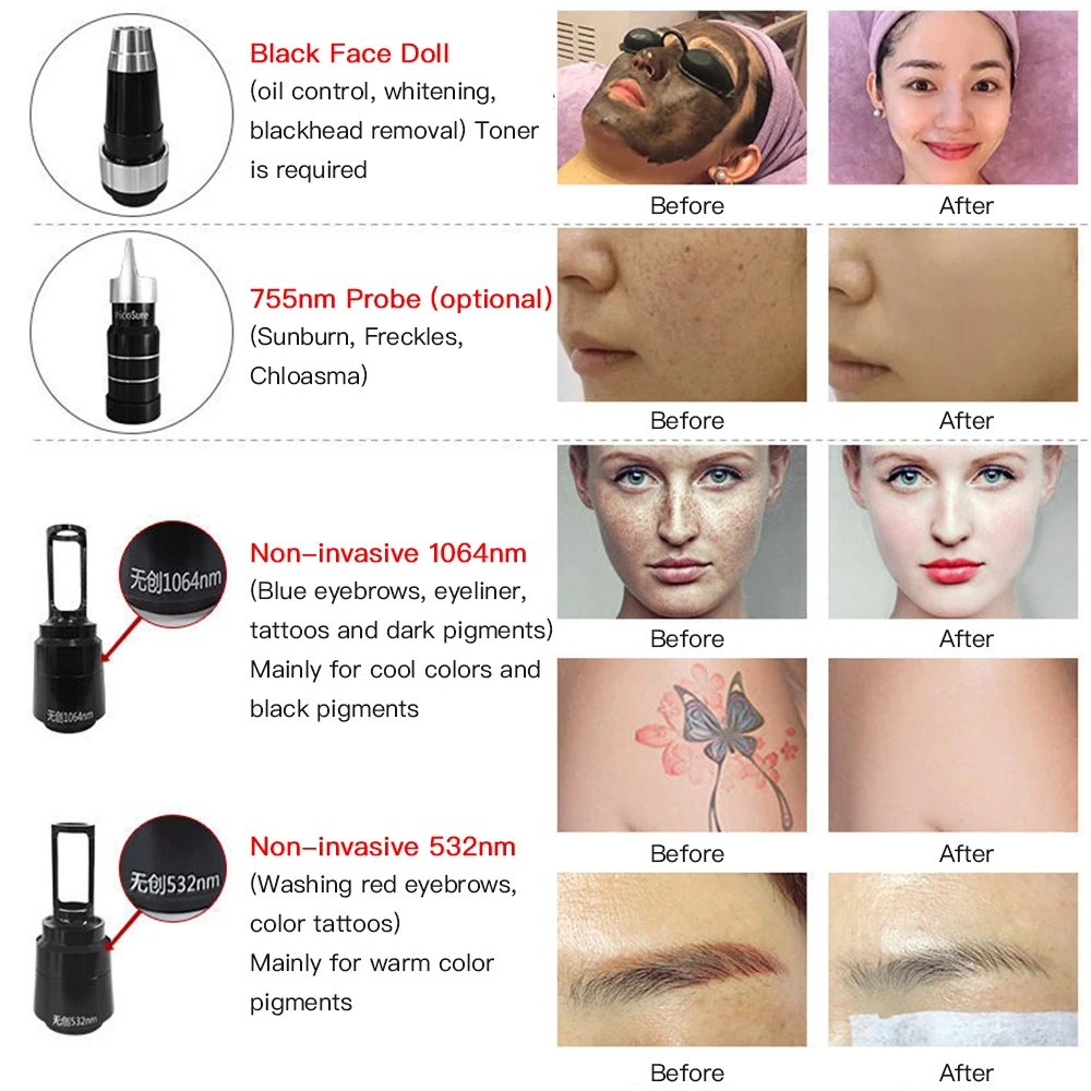 HaoBeauty YAGlaser Portátil Picosegundo Laser Removedor de Sardas Tatuagem com Detecção de Luz Máquina de Lavar Sobrancelha Não Invasiva