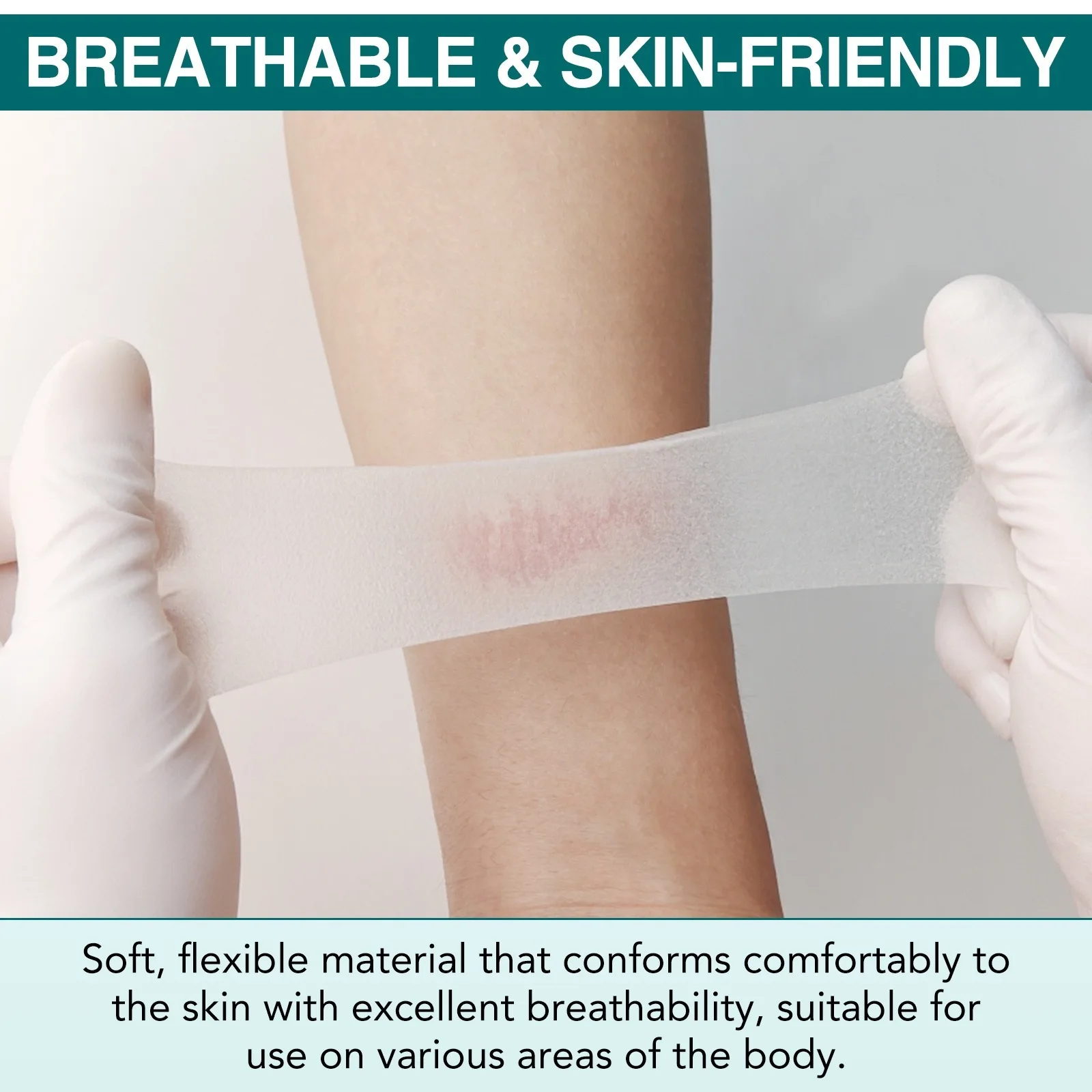 Hydrocolloid Dressings, Artificial Roll Healing Dressings, Anti-Infection, Soft, Skin-Friendly, Tailable