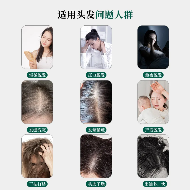 ZHANGGUANG 101 Hair Thicking Strengthening Shampoo 360g Volumizing Oil Control for Thinning Hair, Breakage for Fuller Look