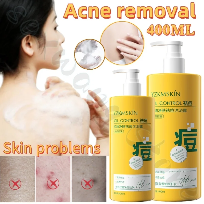 400ml high moisturizing shower gel for men and women's body wash to improve acne dull skin refreshing moisturizing shower gel