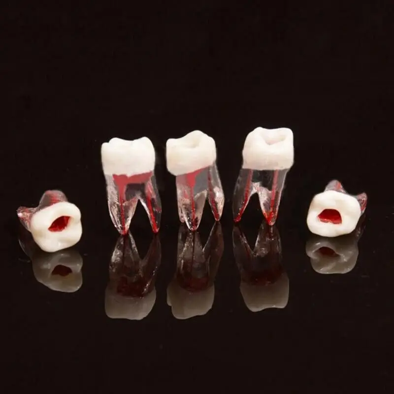 10Pcs Dental Root Canal Teeth Study Model Block Pulp Cavity Practice Block #36 1:1 Natural size