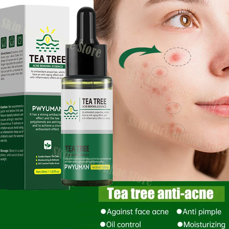 Árbol de té eliminación de acné suero reparación acné suero aceite retráctil poros eliminar puntos negros limpieza Facial desvanecimiento marcas de