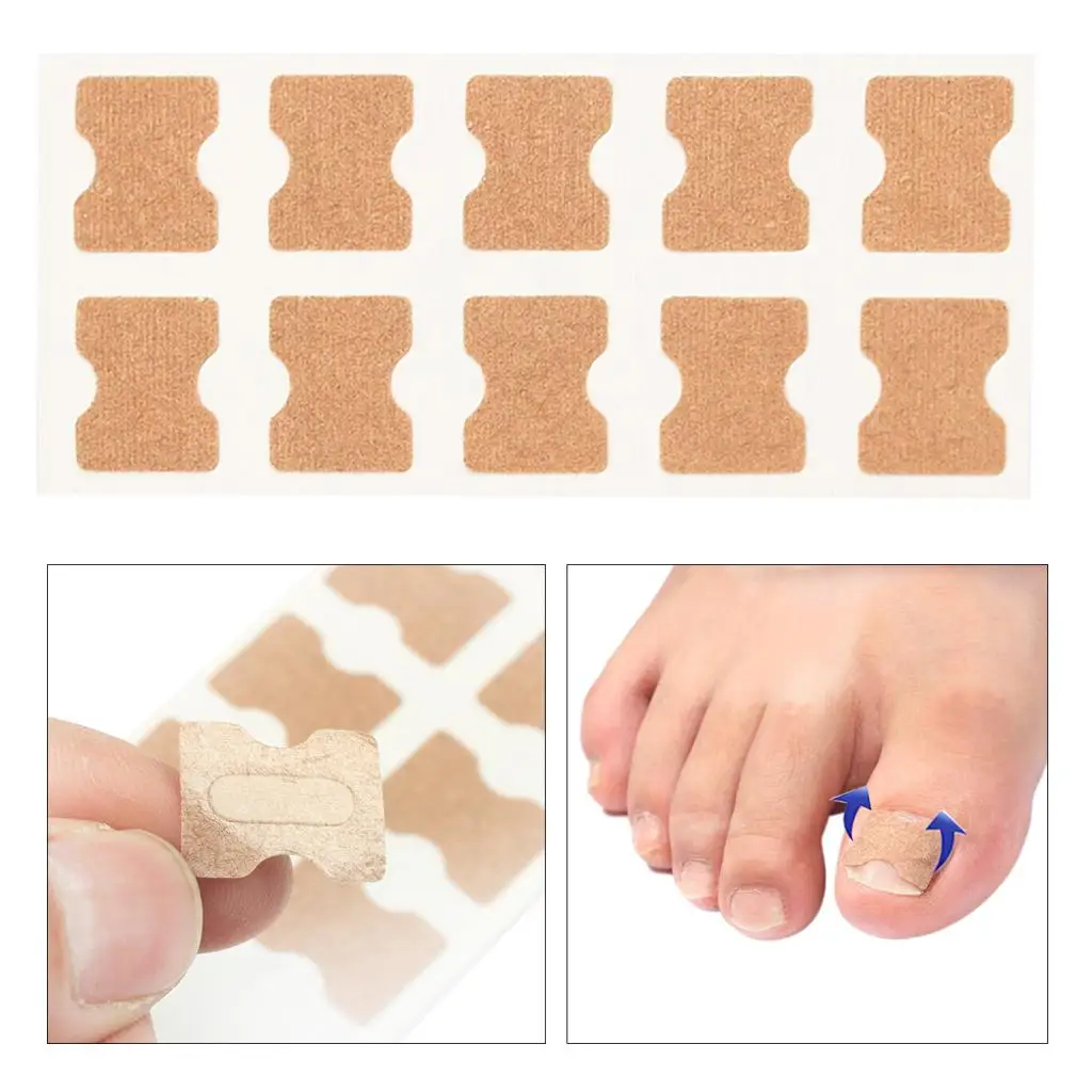 Pegatinas correctoras de uñas de los pies, herramientas correctoras elásticas para uñas de los pies, corrección