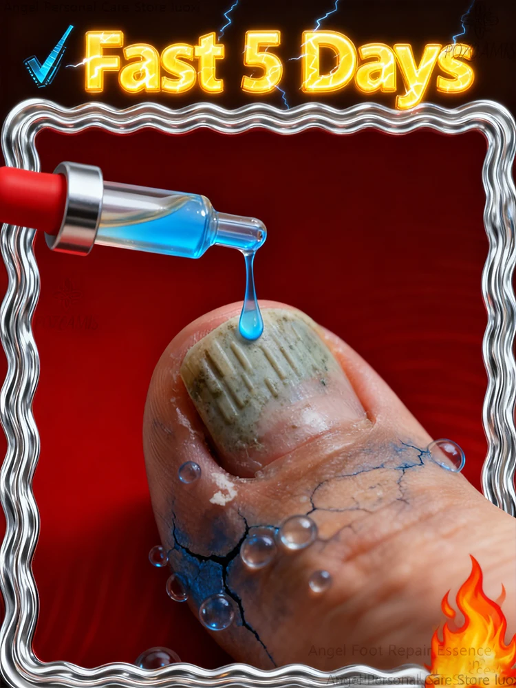 

Нежно массаж до впитывающегося. Продолжить в использовании и ожидает здоровый блеск к возврата.