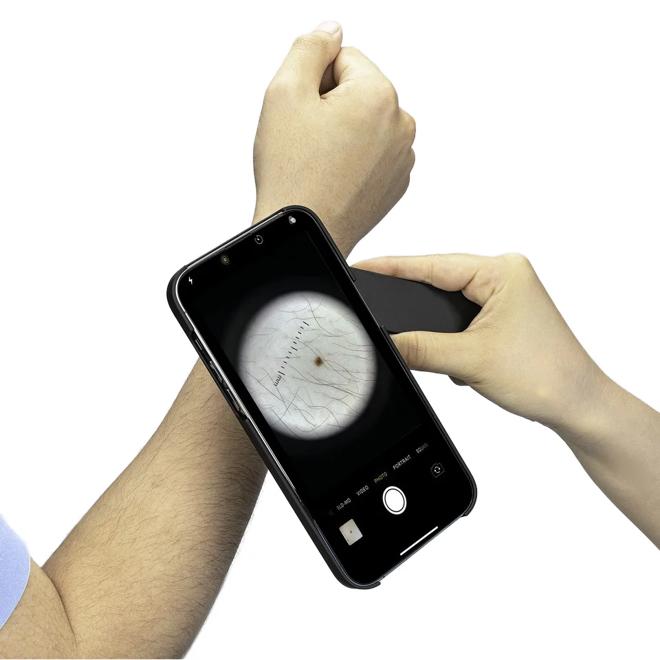 

IBOOLO Dermatoscope DE-4100 High Quality Handheld And Smartphone Dermatoscope Dermascopy Dermoscope